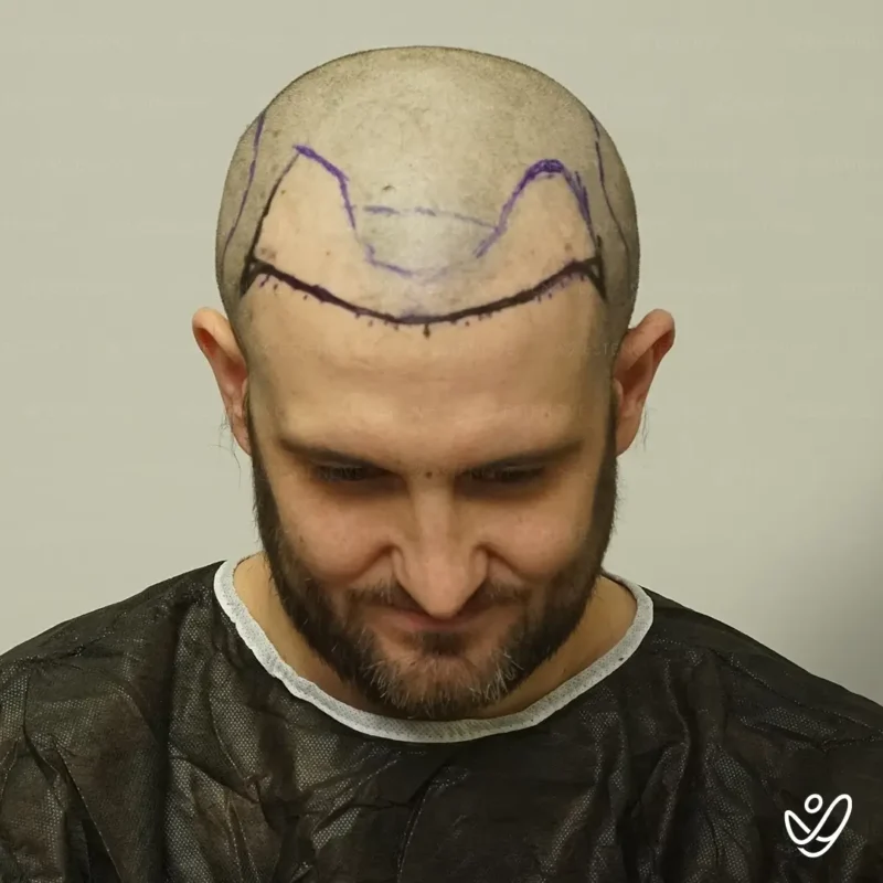 Joey_Intrabartolo-9A (1) before hair transformation