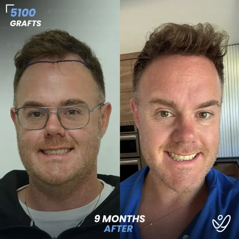 Michael_Champoux1 (1) Michael_Champoux1 (1)