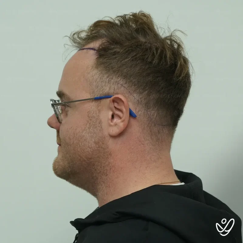 Michael_Champoux10 (1) Michael_Champoux10 (1)