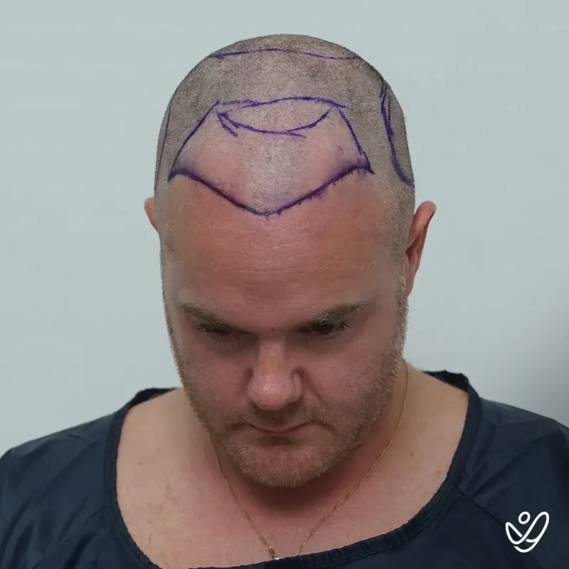 Michael_Champoux12 (1) Michael_Champoux12 (1)