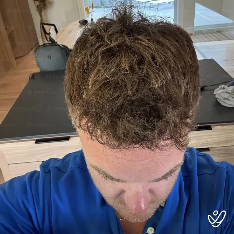 Michael_Champoux13 (1) Michael_Champoux13 (1)