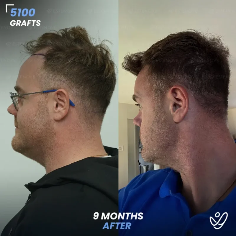 Michael_Champoux3 (1) Michael_Champoux3 (1)