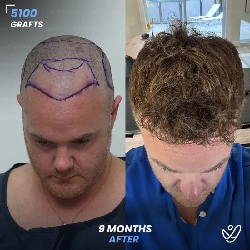 Michael_Champoux4 (1) Michael_Champoux4 (1)