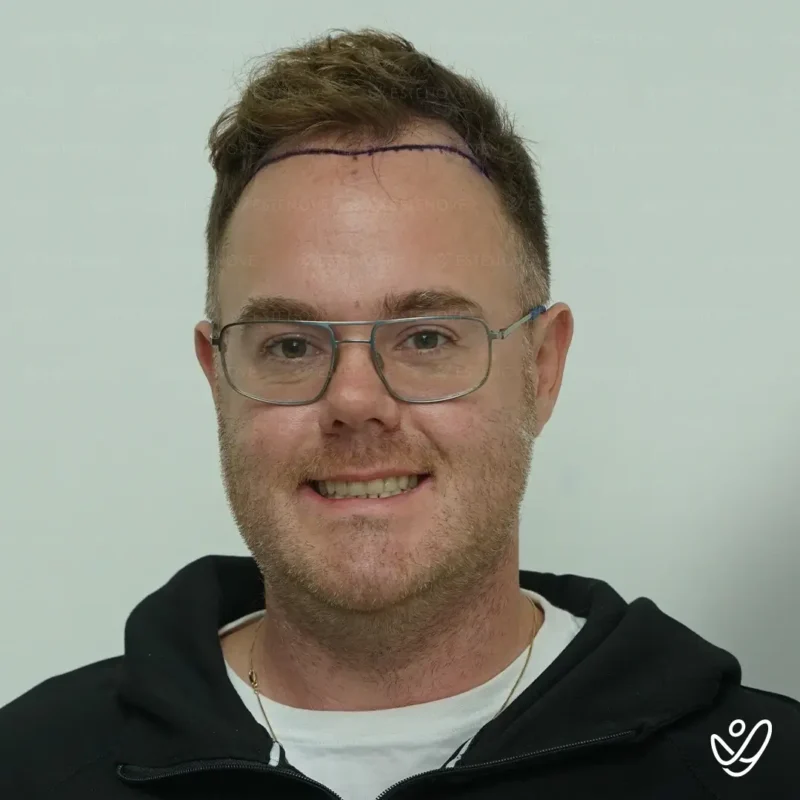 Michael_Champoux6 (1) Michael_Champoux6 (1)