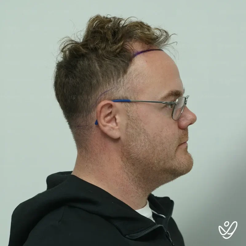 Michael_Champoux8 (1) Michael_Champoux8 (1)