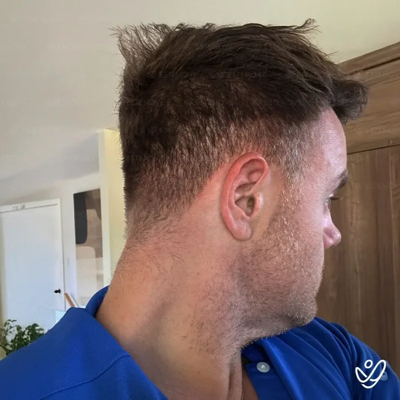 Michael_Champoux9 (1) Michael_Champoux9 (1)