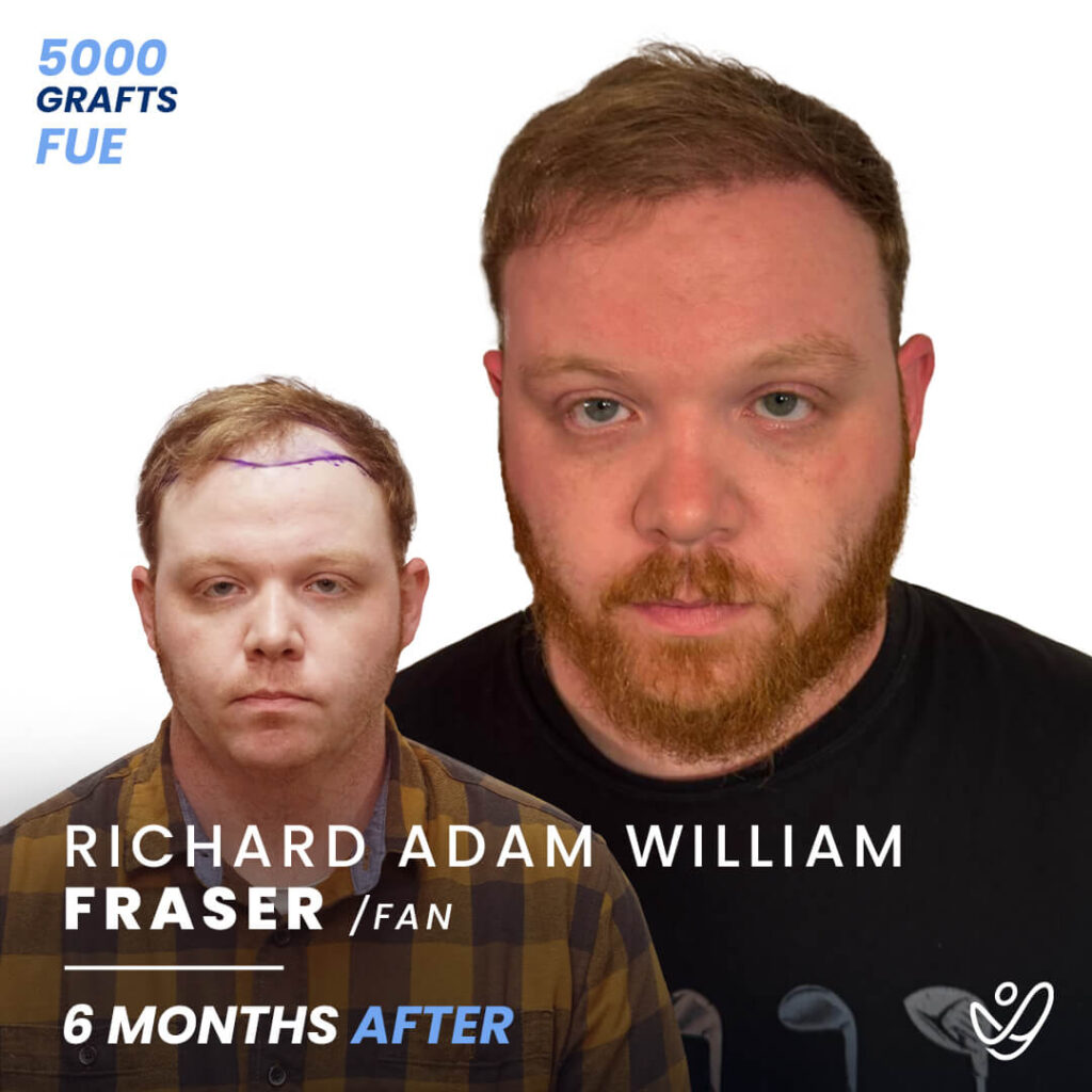 RICHARD_ADAM_WILLIAM FRASER