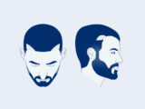 1500 grafts hair transplant