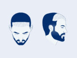 4000 Grafts Hair Transplant