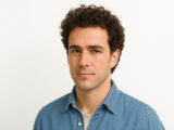 hair transplant for curly hair