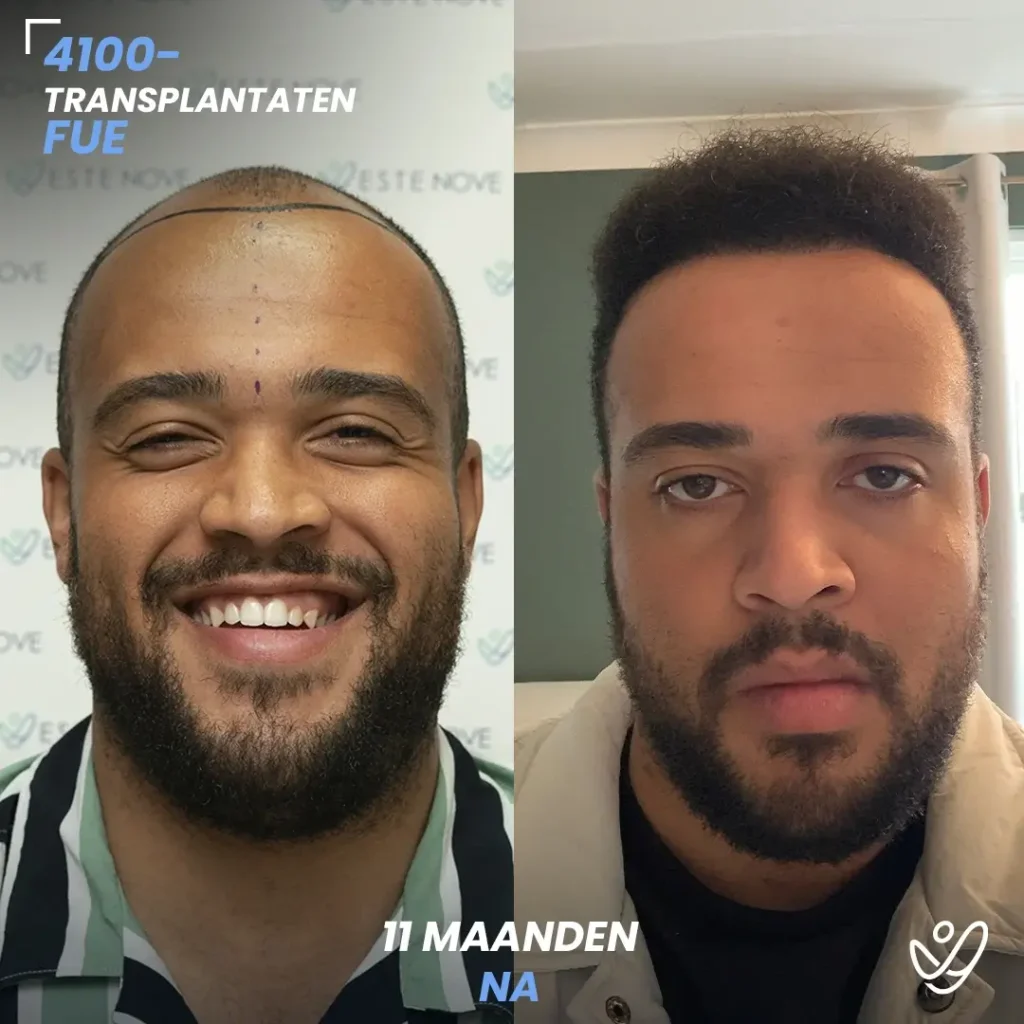 B&A-POST_Template_DU-B&A1