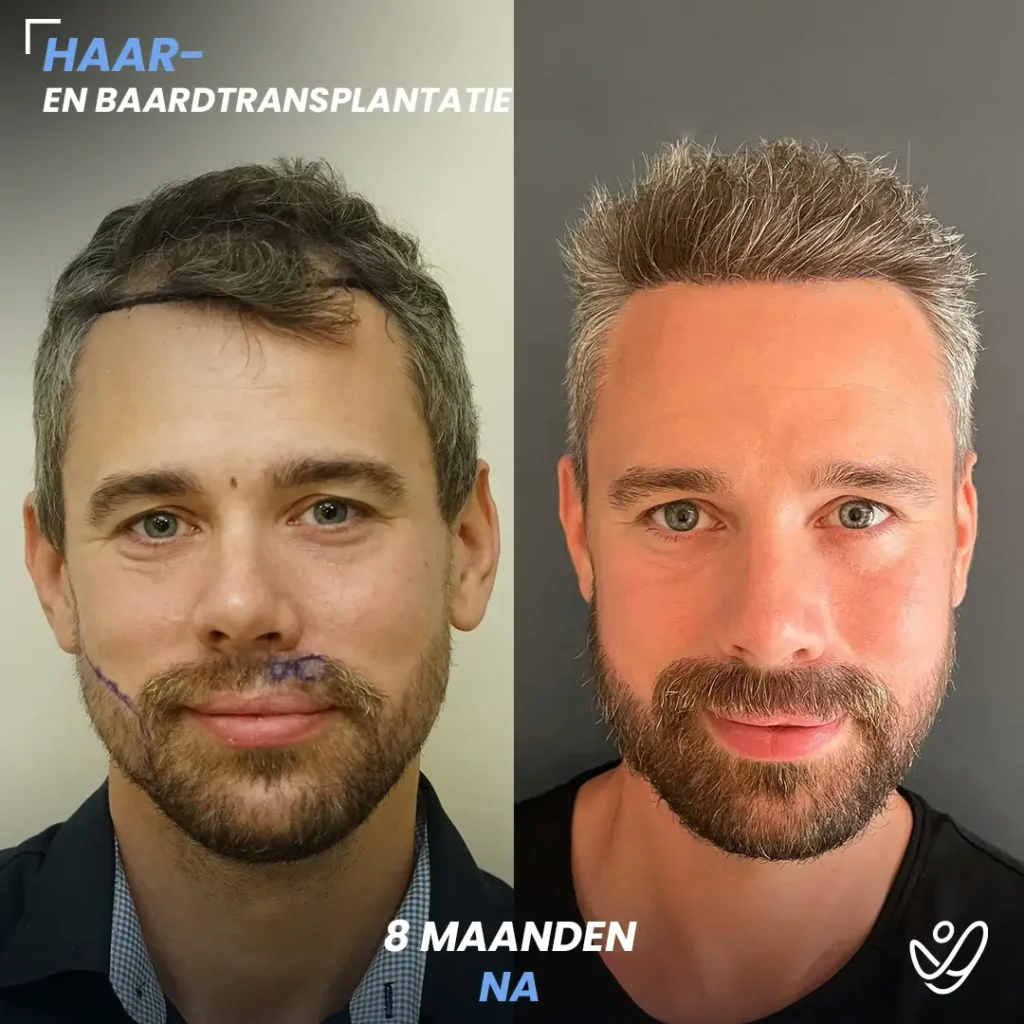 B&A-POST_Template_DU-B&A2