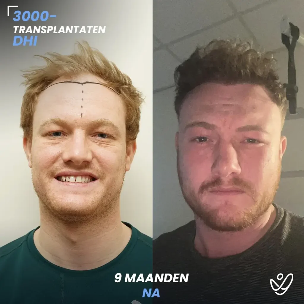 B&A-POST_Template_DU-B&A5 (1)