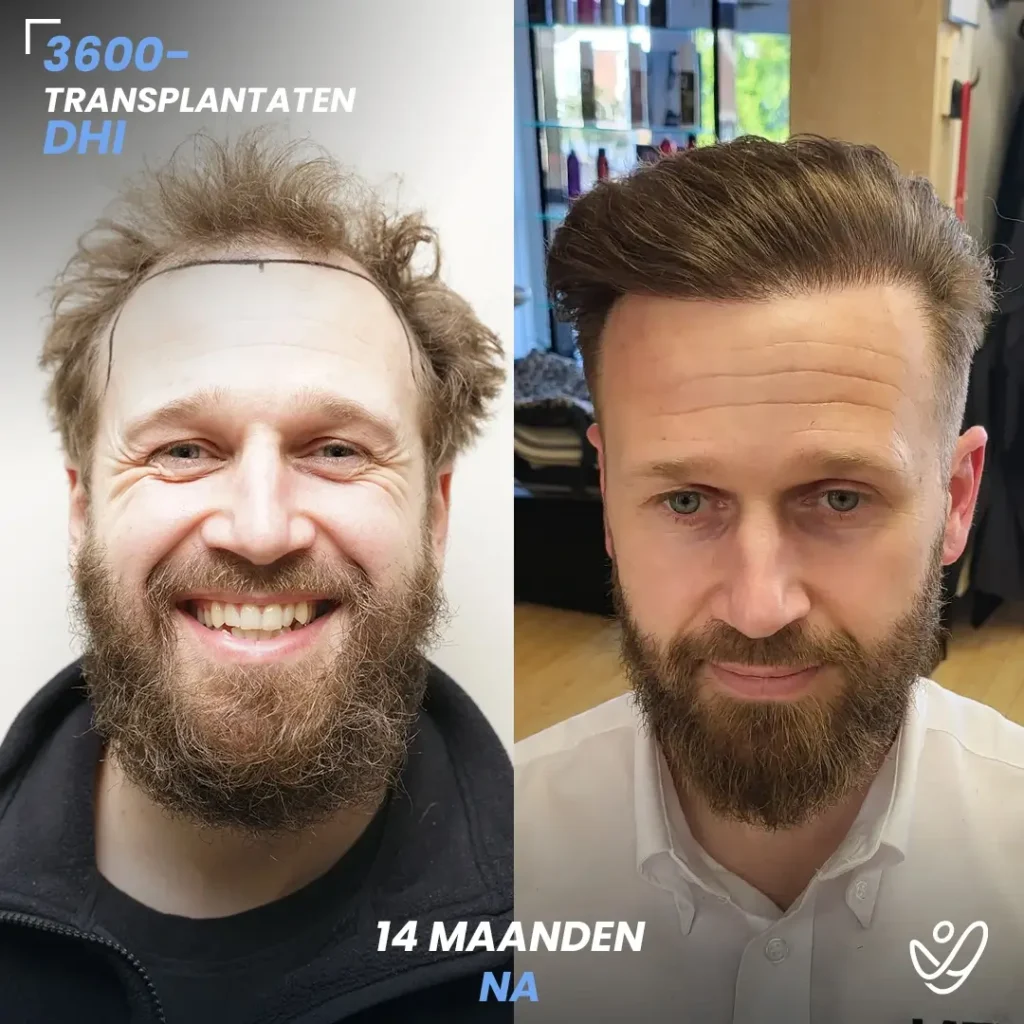 B&A-POST_Template_DU-B&A7 (1)