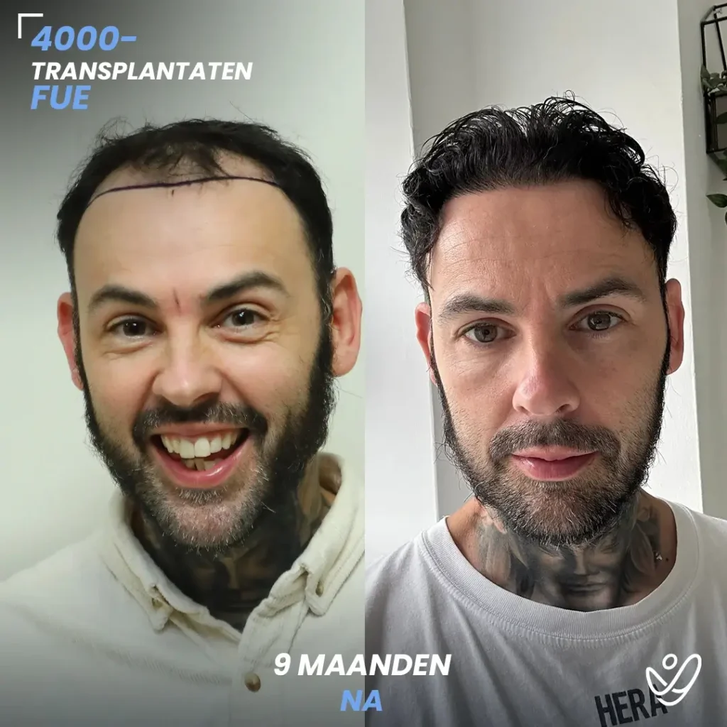 B&A-POST_Template_DU-B&A8