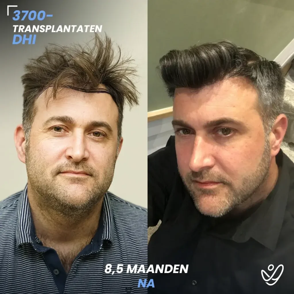 B&A-POST_Template_DU-B&A9 (1)