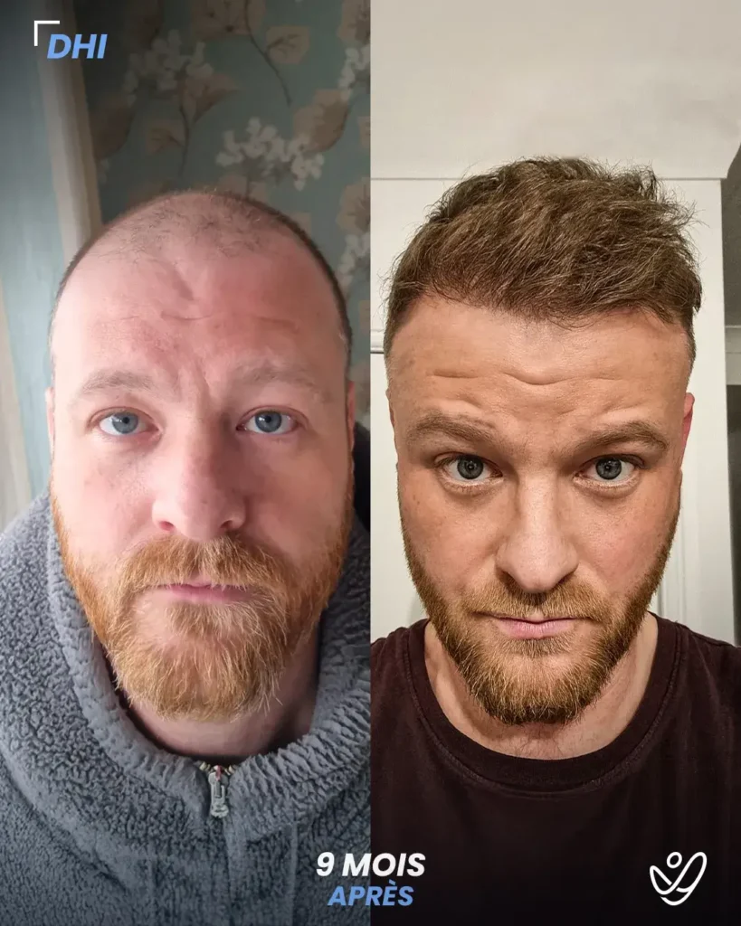 Mitchael Hutchinson (2)