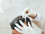benefits of stem cell therapy for hair growth