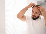 hair transplant side effects