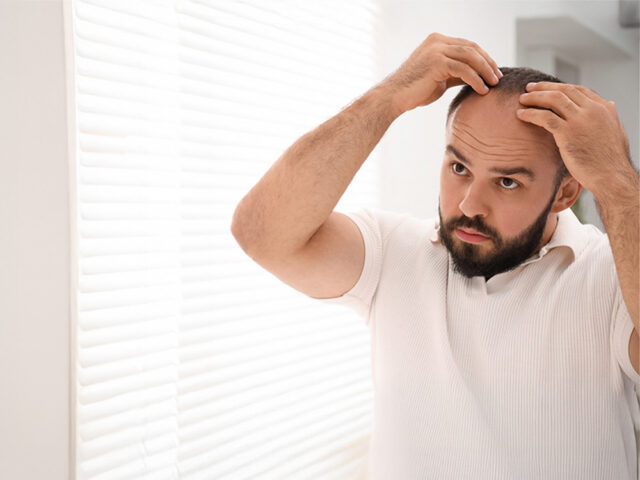 hair transplant side effects