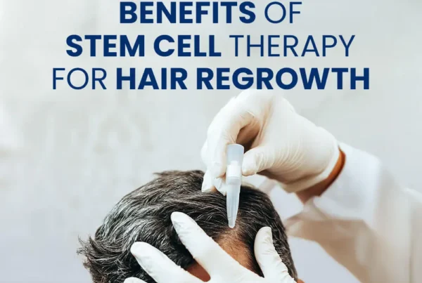 Gloved hands applying a treatment to a scalp with text "Benefits Of Stem Cell Therapy For Hair Regrowth"