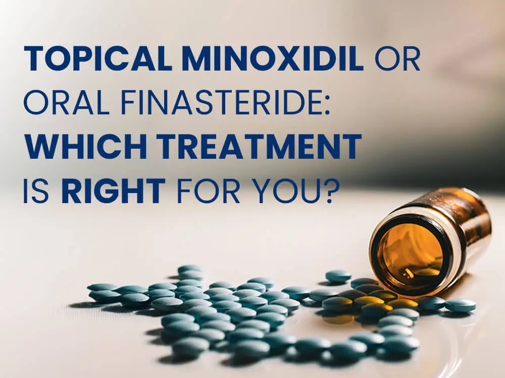 Blue pills spilled from an amber bottle with text "Topical Minoxidil Or Oral Finasteride: Which Treatment Is Right For You?"