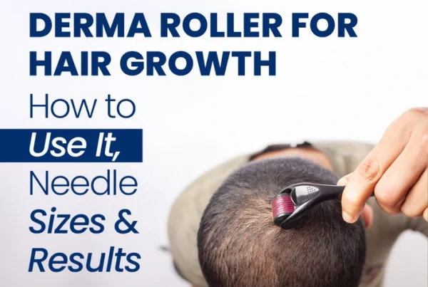 Person using a derma roller on their scalp with text about using a derma roller for hair growth, needle sizes, and results.