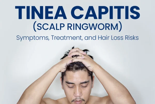 Man holding his head with text "Tinea Capitis (Scalp Ringworm): Symptoms, Treatment, and Hair Loss Risks."