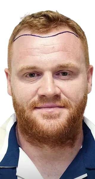 Kyle Plump - BEFORE