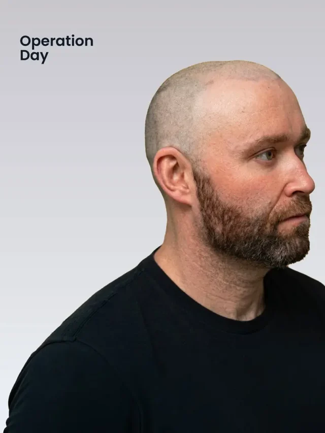 David - op-day