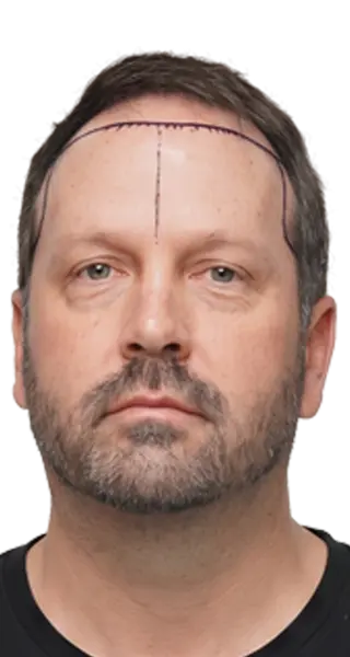 Nathan Squire Merrill - BEFORE