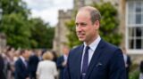 prince william hair loss