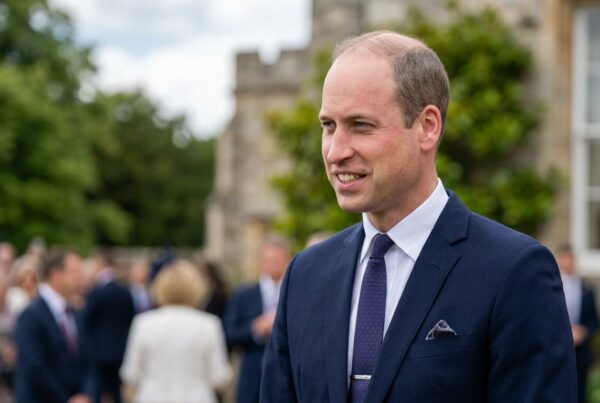 prince william hair loss