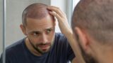 hair transplant itching