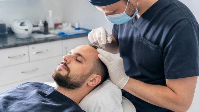 is hair transplant painful