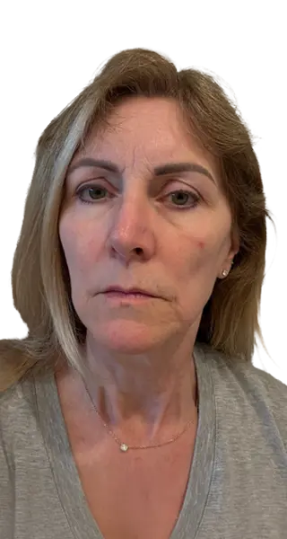 Denise Sylvia Dykes - AFTER