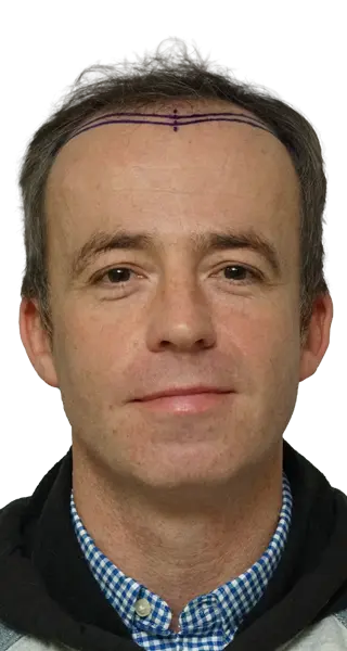 Gareth Roberts - BEFORE