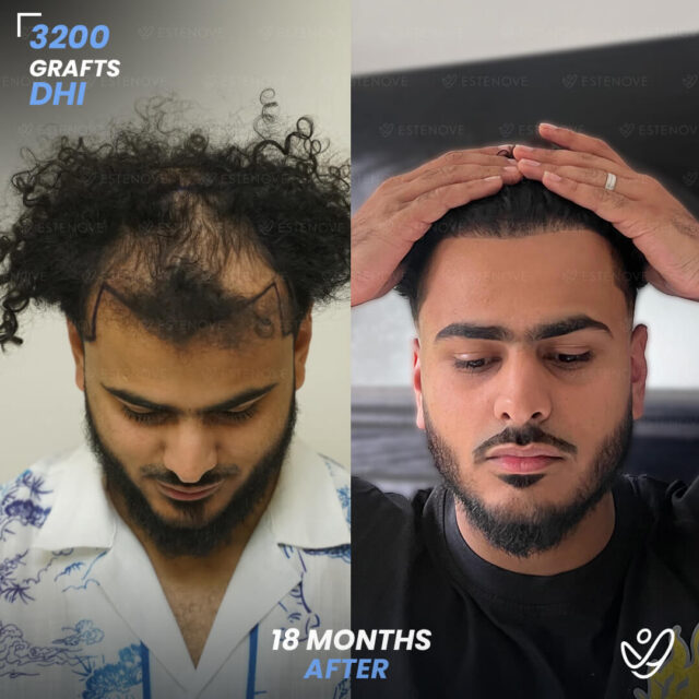 Hossam - 2
