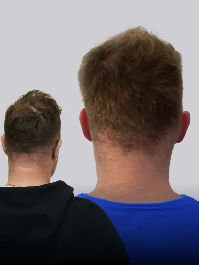 Michael Champoux transformation - 5