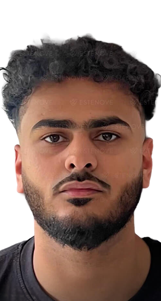 Hossam - after