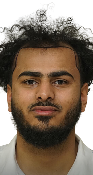 Hossam - before