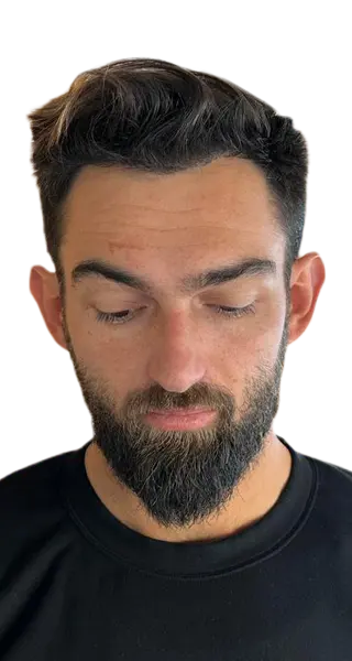 Randy Lehoe - AFTER