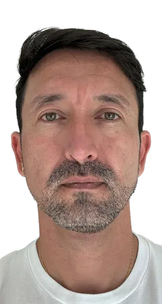 Wilmer Sanchez - AFTER