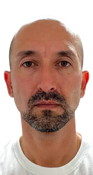 Wilmer Sanchez - BEFORE