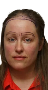 Melissa Gebauer - BEFORE