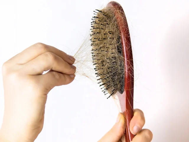 pcos hair loss, causes and treatment options